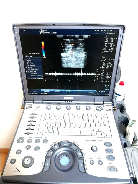 GE Logiq e Portable Ultrasound