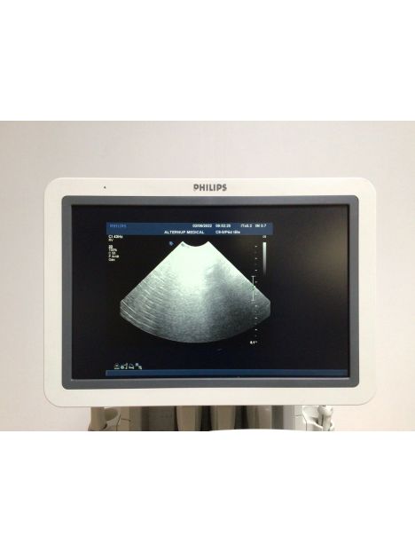 Echographe Philips iU22