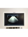 Philips iU22 Ultrasound