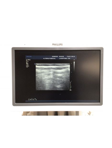 Echographe Philips iU22