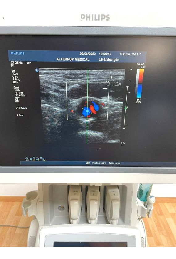 Philips iU22 Ultrasound