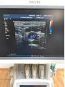 Philips iU22 Ultrasound