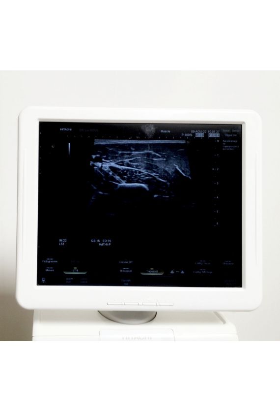 Echographe Hitachi Hi Vision Avius