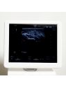 Echographe Hitachi Hi Vision Avius