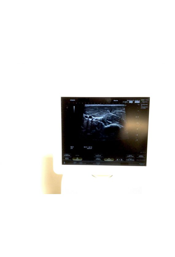 Echographe Hitachi Hi Vision Avius