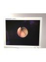 Fibroscope d'Intubation Olympus LT-TP