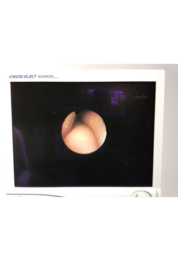 Fibroscope d'Intubation Olympus LT-TP