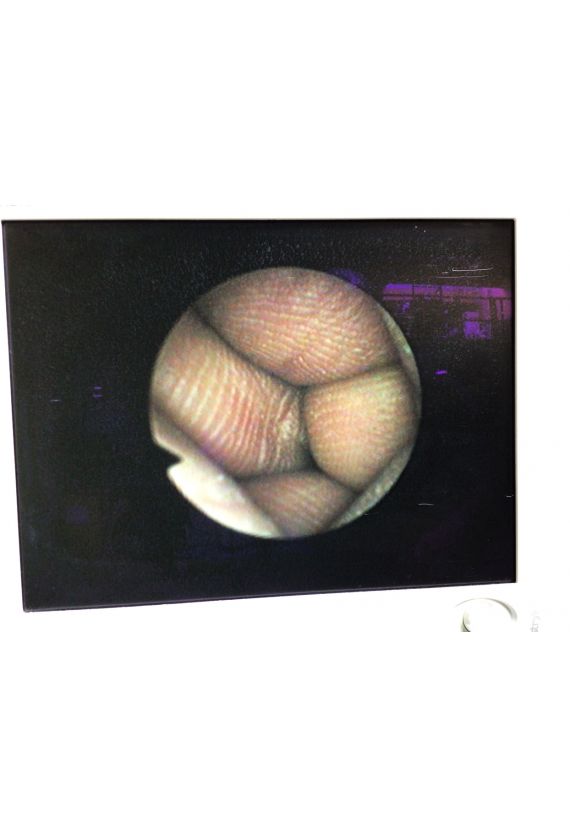 Olympus LF-GP  Rhino-Laryngo Fiberscope