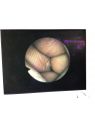 Olympus LF-GP  Rhino-Laryngo Fiberscope