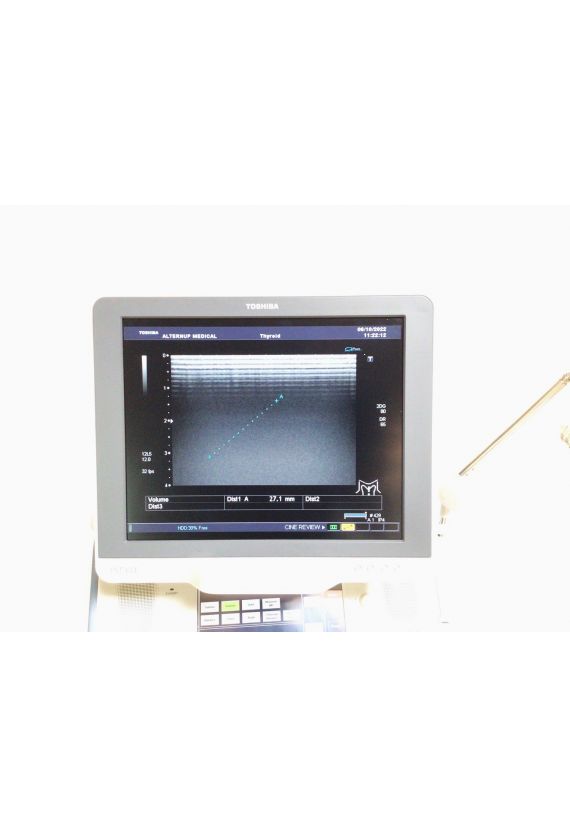 Toshiba Xario SSA-660A Ultrasound