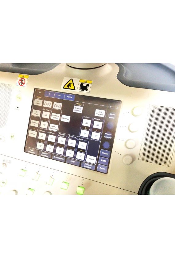 Toshiba Xario SSA-660A Ultrasound