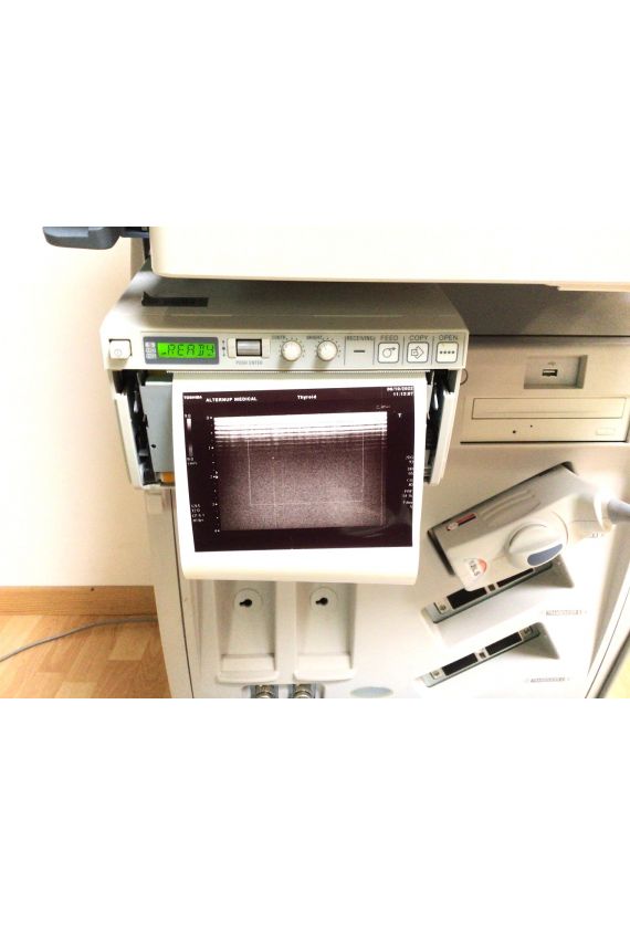 Toshiba Xario SSA-660A Ultrasound