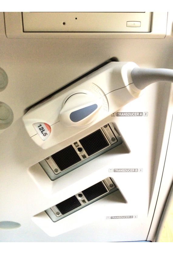 Toshiba Xario SSA-660A Ultrasound