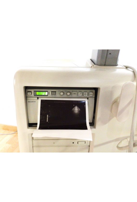 Philips HD11XE Cardiac Ultrasound