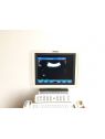 Philips HD11XE Cardiac Ultrasound