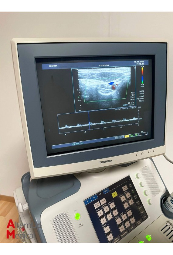 Echographe Toshiba Xario SSA-660A