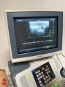 Echographe Toshiba Xario SSA-660A