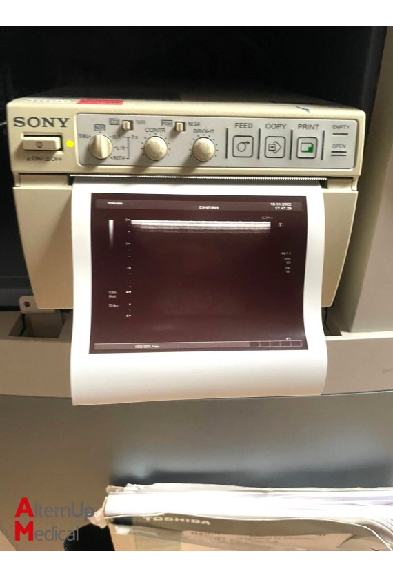 Toshiba Xario SSA-660A Ultrasound