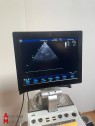 Echocardiographe GE Vivid S6