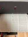 Cardiotocographe HP 8031A