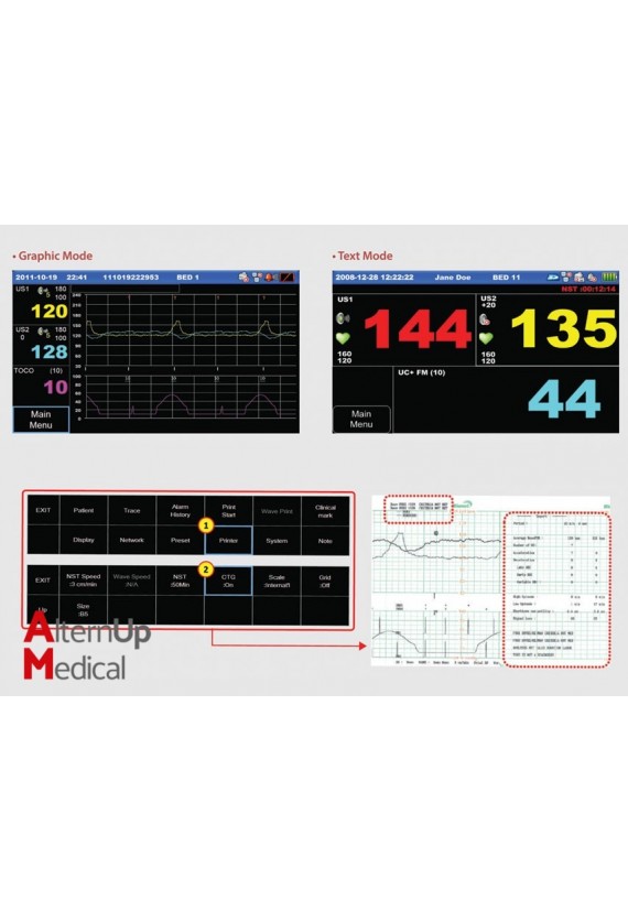 Cardiotocographe Gémellaire FC1400