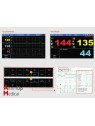 FC1400 Twins Foetal Monitor