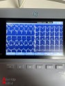 GE MAC 1600 Electrocardiograph
