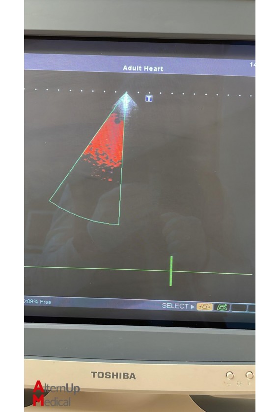 Toshiba Xario SSA-660A Ultrasound