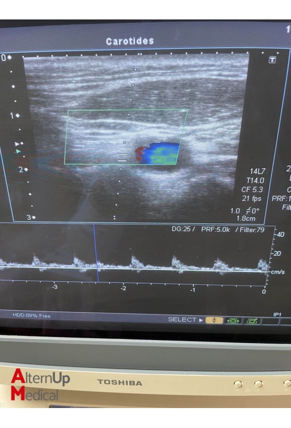 Toshiba Xario SSA-660A Ultrasound