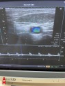 Toshiba Xario SSA-660A Ultrasound