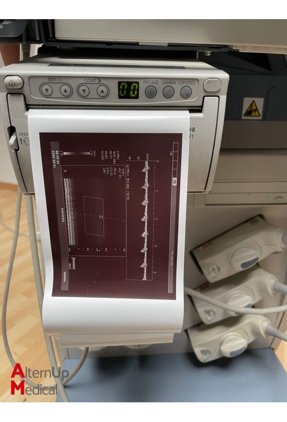 Toshiba Xario SSA-660A Ultrasound
