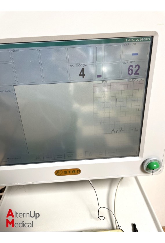 Moniteur Foetal Cardiotocographe Neoventa Stan S31