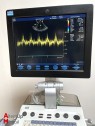 Echographe Cardiaque GE Vivid S6