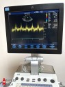 GE Vivid S6 Cardiac Ultrasound