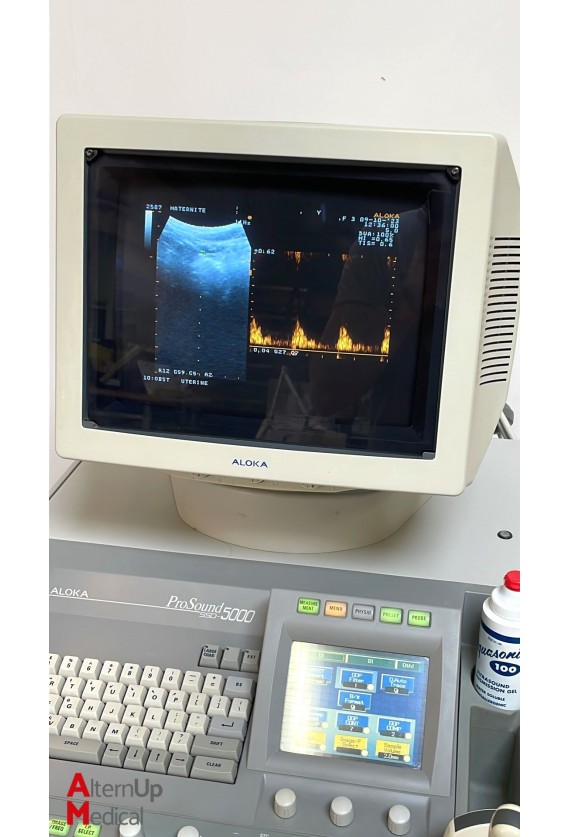 Echographe Aloka Prosound SSD-5000