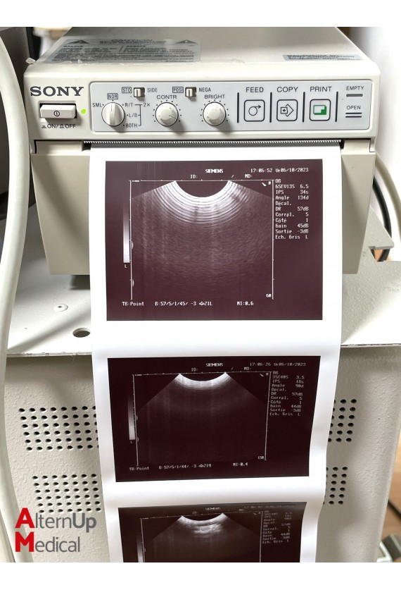 Siemens Sonoline Adara Ultrasound