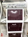 Siemens Sonoline Adara Ultrasound