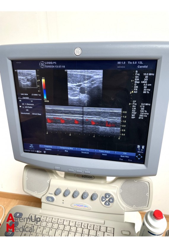 Echographe GE Logiq P5