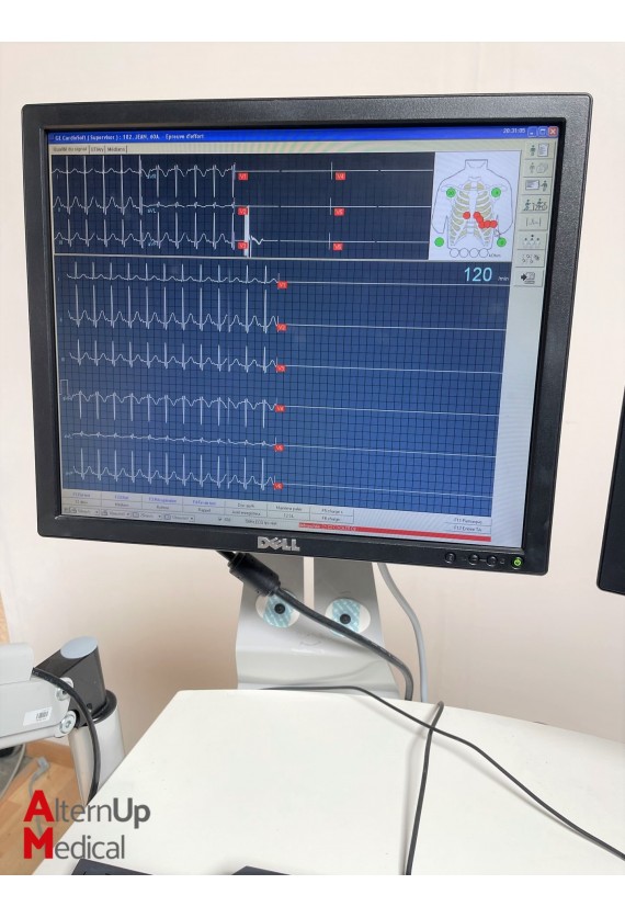 GE Stress Test Station with E-Bike and Spirometer