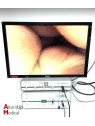 Landanger Laparoscopy and Coelioscopy Video Pack