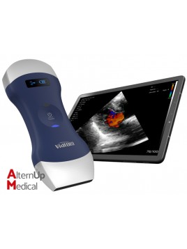 Echographe Portable Double Tête Linéaire Convexe