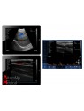 Echographe Portable Double Tête Linéaire Convexe