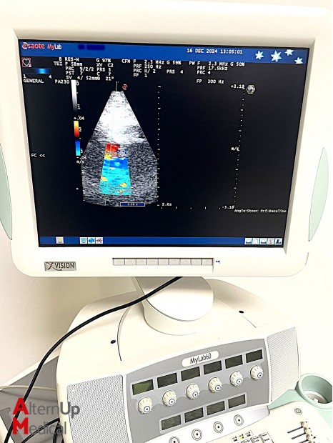 Esaote MyLab 60 Ultrasound Cardiology Specialty - Alternup Medical