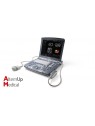 Echographe portable Voluson e