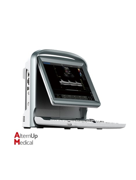 Chison ECO5 Portable Ultrasound