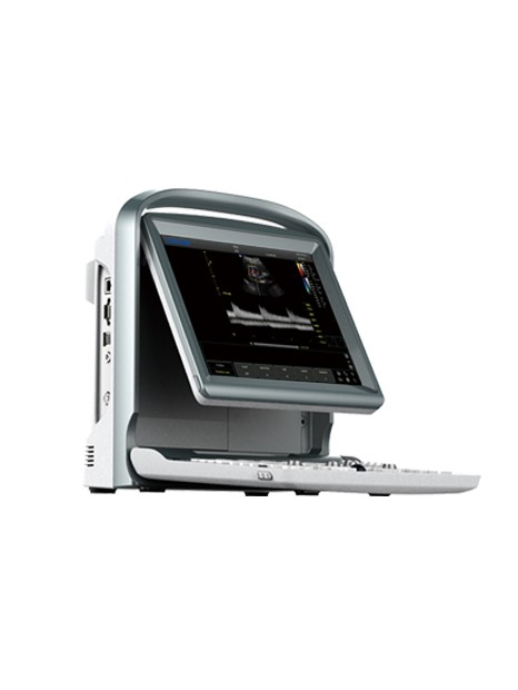 Chison ECO5 Portable Ultrasound