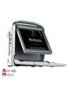 Chison ECO5 Portable Ultrasound