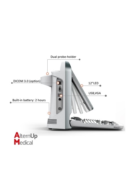 Chison ECO5 Portable Ultrasound