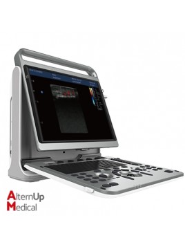 Chison EBit 50 Portable Ultrasound