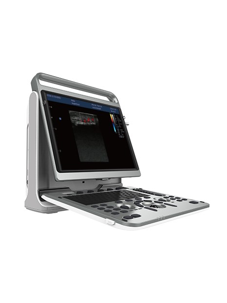 Chison EBit 50 Portable Ultrasound